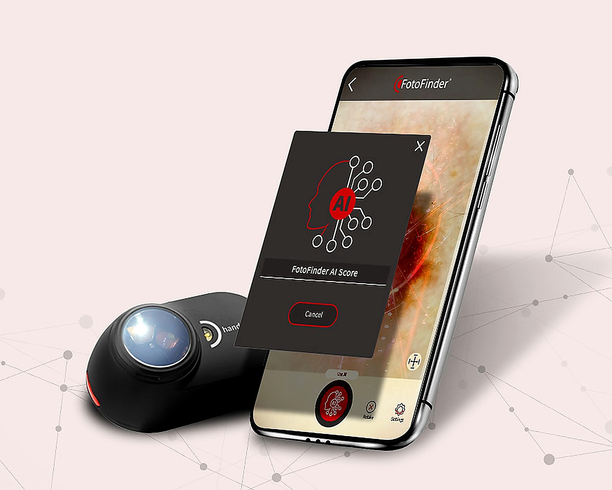 Digitale Auflichtmikroskopie mit dem FotoFinder Handyscope zur Hautanalyse